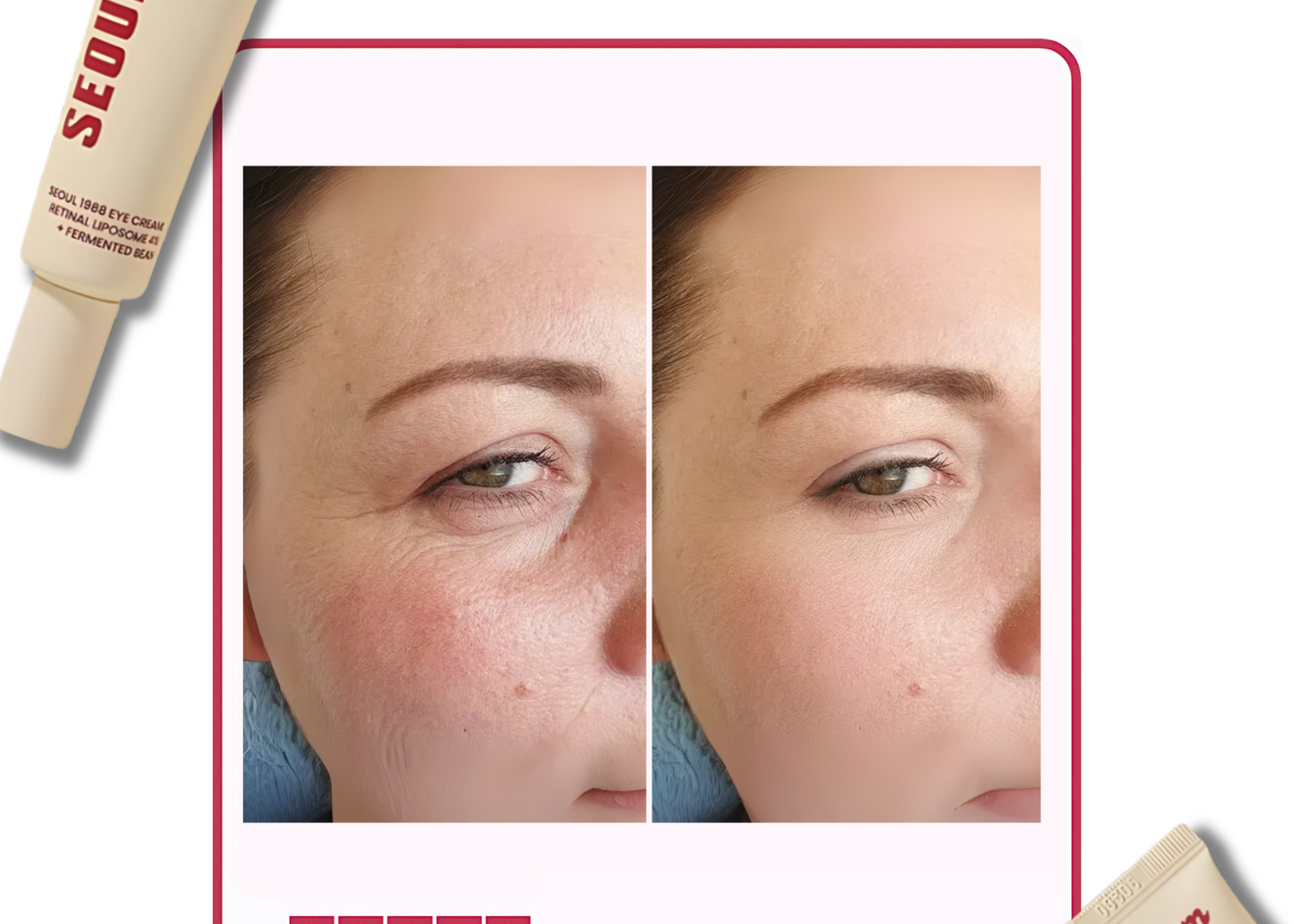 Loyvera - 4% Retinal Liposome Treatment