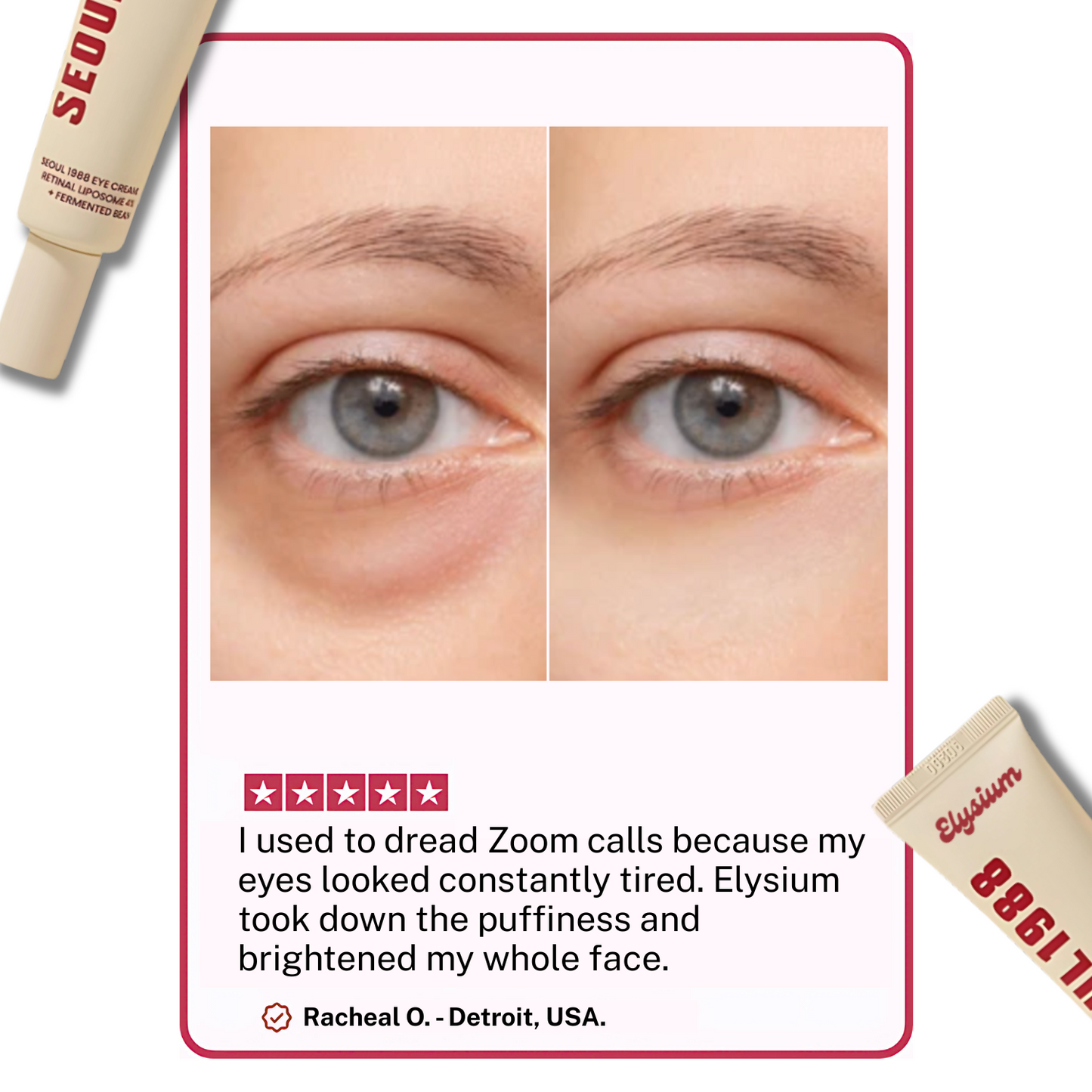 Loyvera - 4% Retinal Liposome Treatment