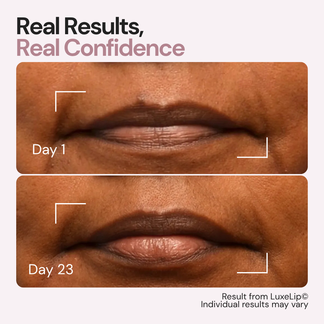 Luxes-Lip - Anti-ageing LED wearable device for youthful lips