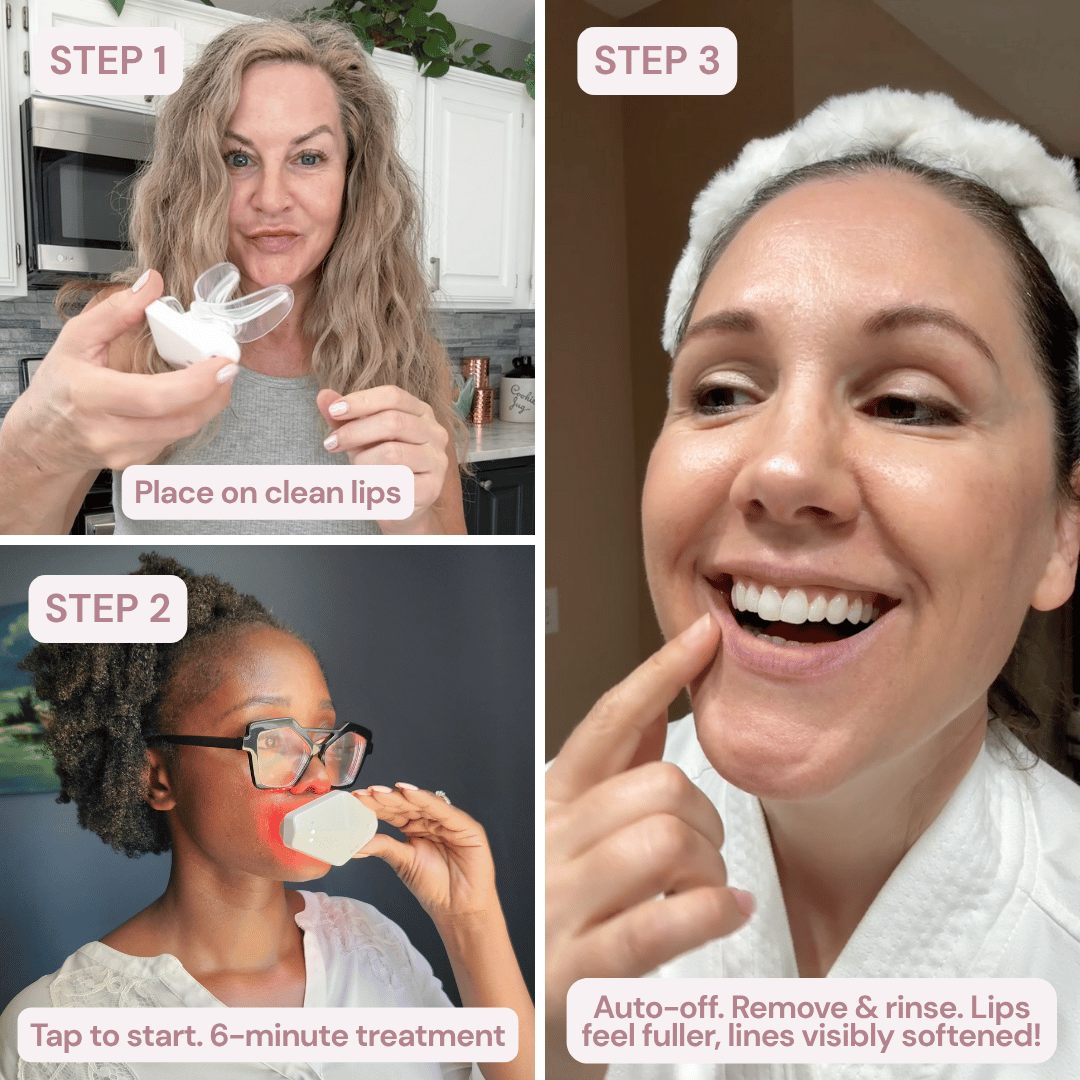 Luxes-Lip - Anti-ageing LED wearable device for youthful lips