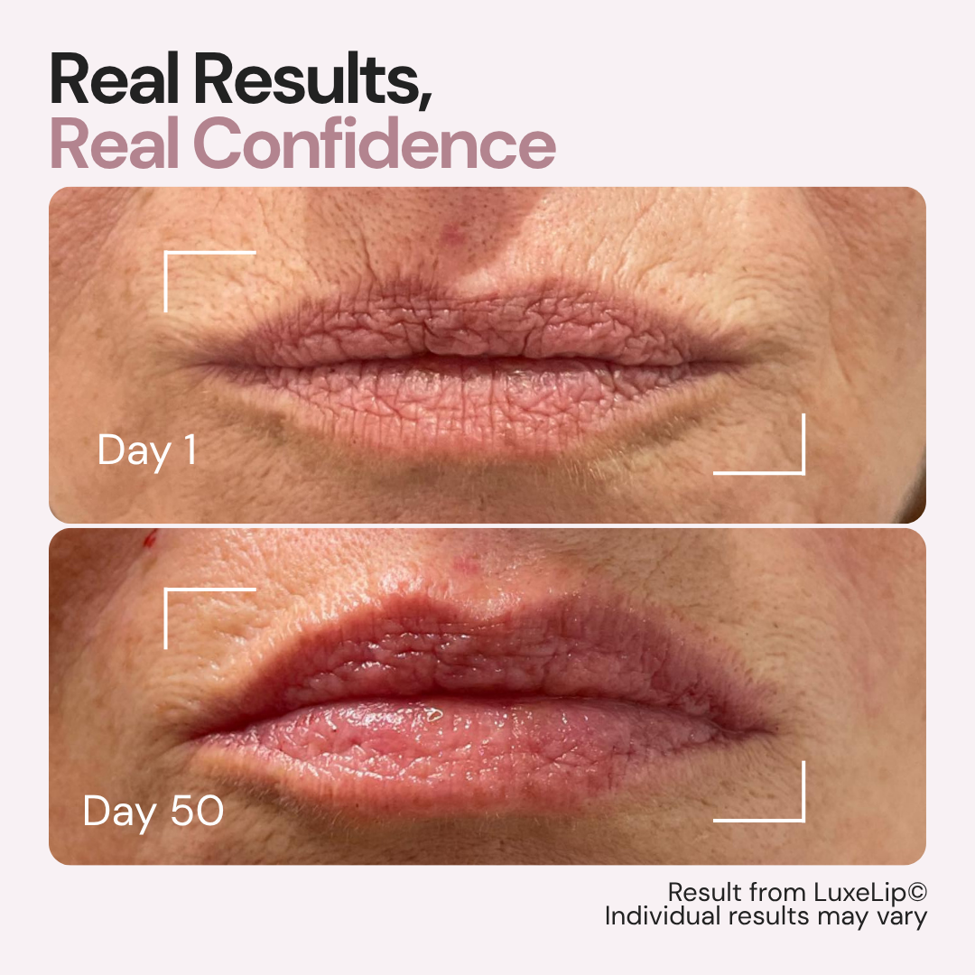 Luxes-Lip - Anti-ageing LED wearable device for youthful lips