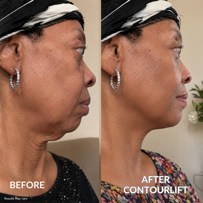 ContourLift™ Mask