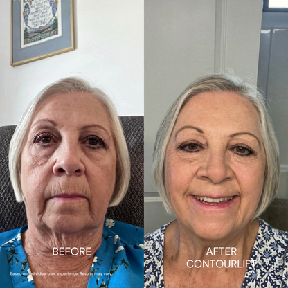 ContourLift™ Mask