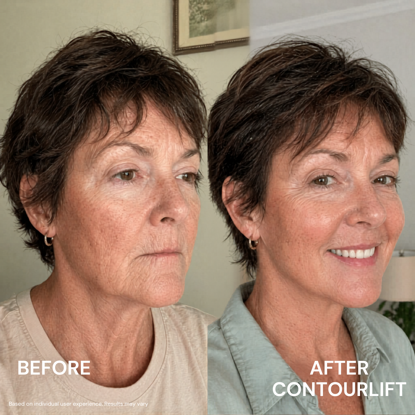ContourLift™ Mask