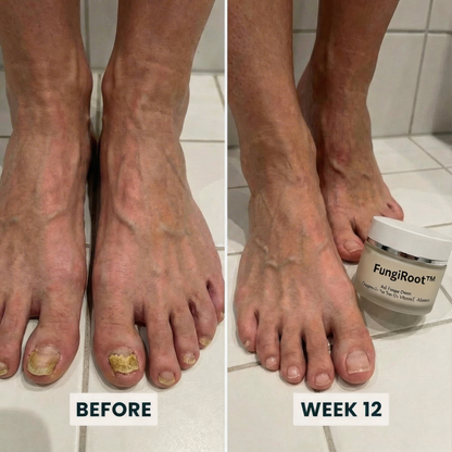FungiRoot™ Restore Cream