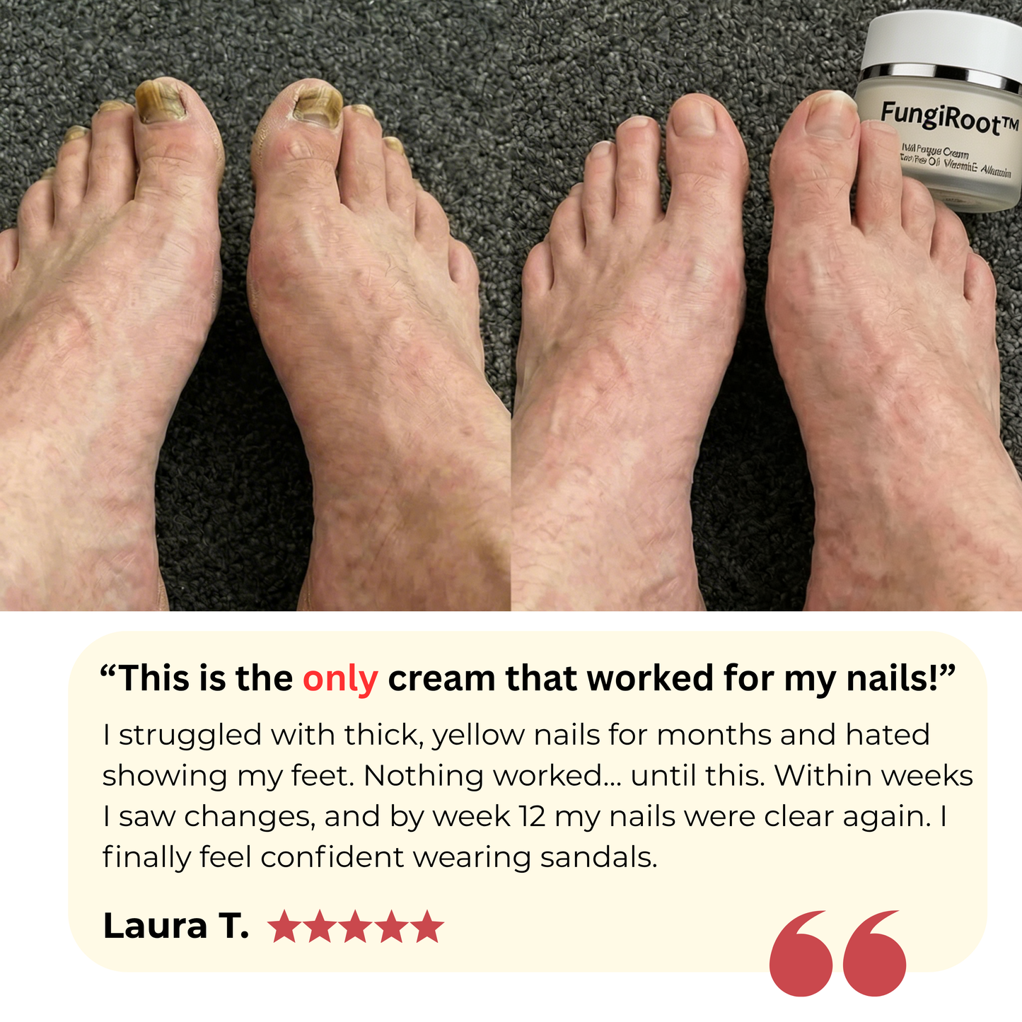 FungiRoot™ Restore Cream