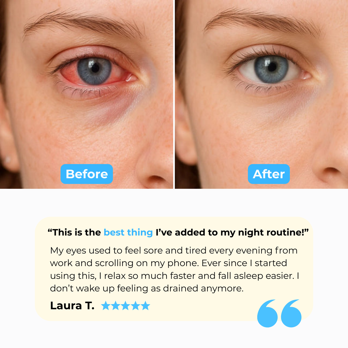 Luniva™ Sleep Eye Massager