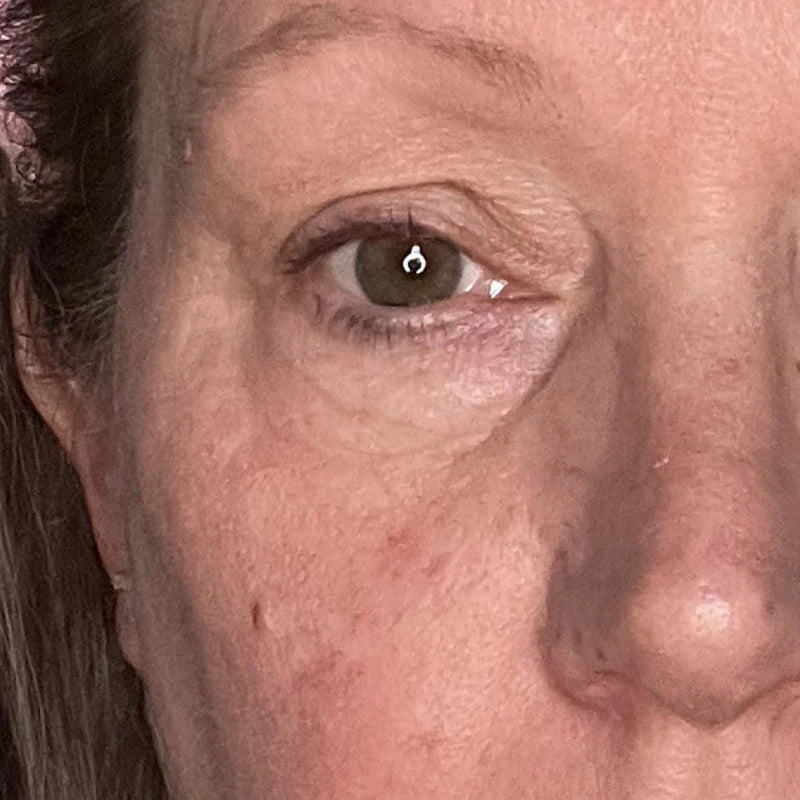 Day 1