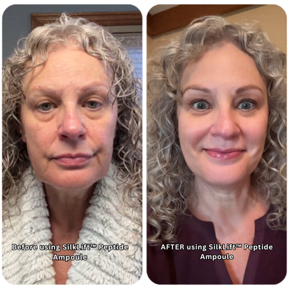 SilkLift™ Peptide Ampoule