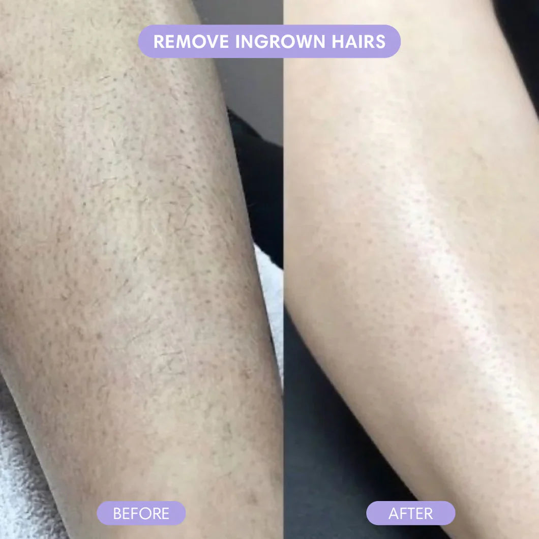 SmoothMist™ - Body Hair Removal Spray