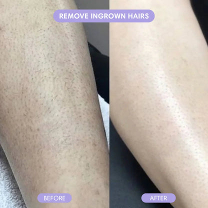 SmoothMist™ - Body Hair Removal Spray