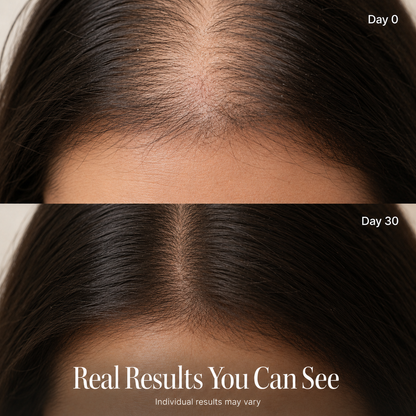 RootRevive™ Korean Scalp Renewal Serum