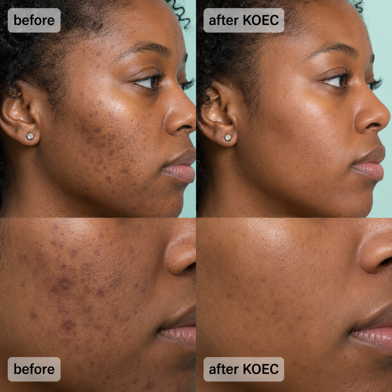 KOEC™ Micro-crystal Serum PM Duo
