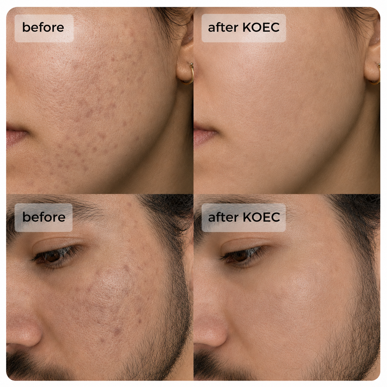 KOEC™ Micro-crystal Serum PM Duo