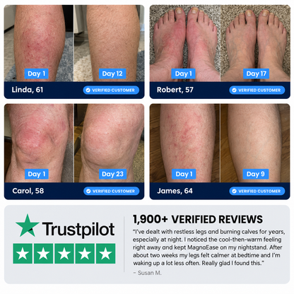 MagnaEase™ Magnesium Chloride Cream for Relief & Recovery