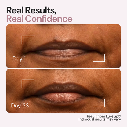 Luxes-Lip - Anti-ageing LED wearable device for youthful lips