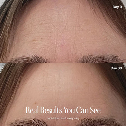 SilkLift™ Peptide Ampoule