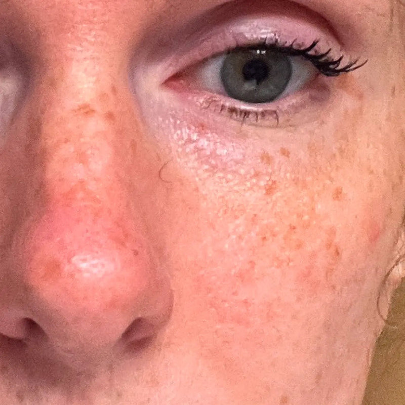 Day 1