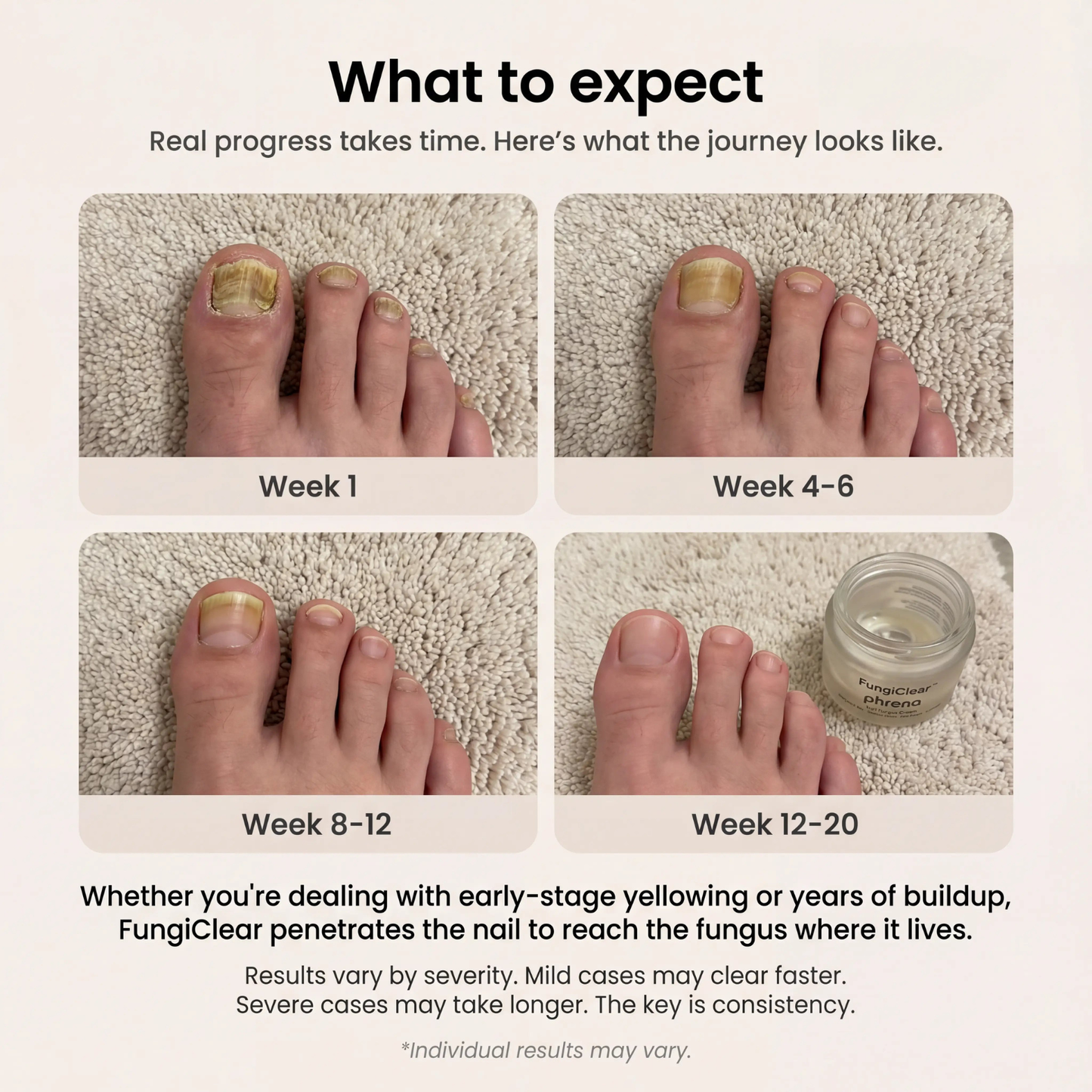 FungiRoot™ Restore Cream