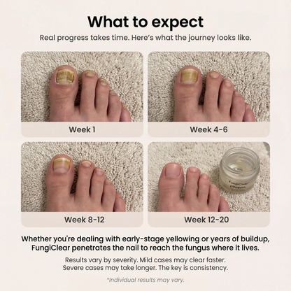 FungiRoot™ Restore Cream