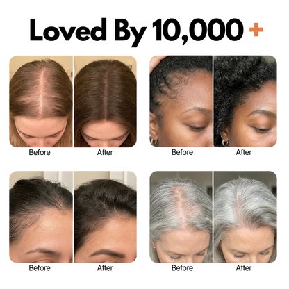 RootRevive™ Korean Scalp Renewal Serum