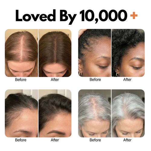 RootRevive™ Korean Scalp Renewal Serum