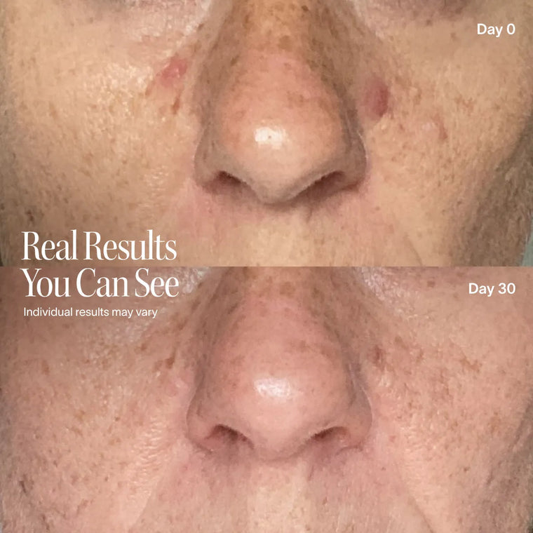 SilkLift™ Peptide Ampoule