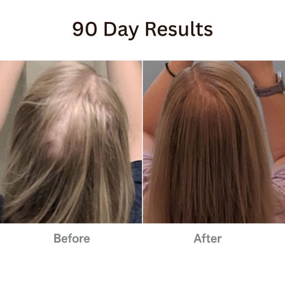 RootRevive™ Korean Scalp Renewal Serum