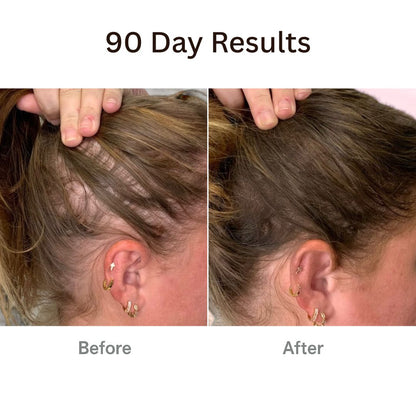 RootRevive™ Korean Scalp Renewal Serum