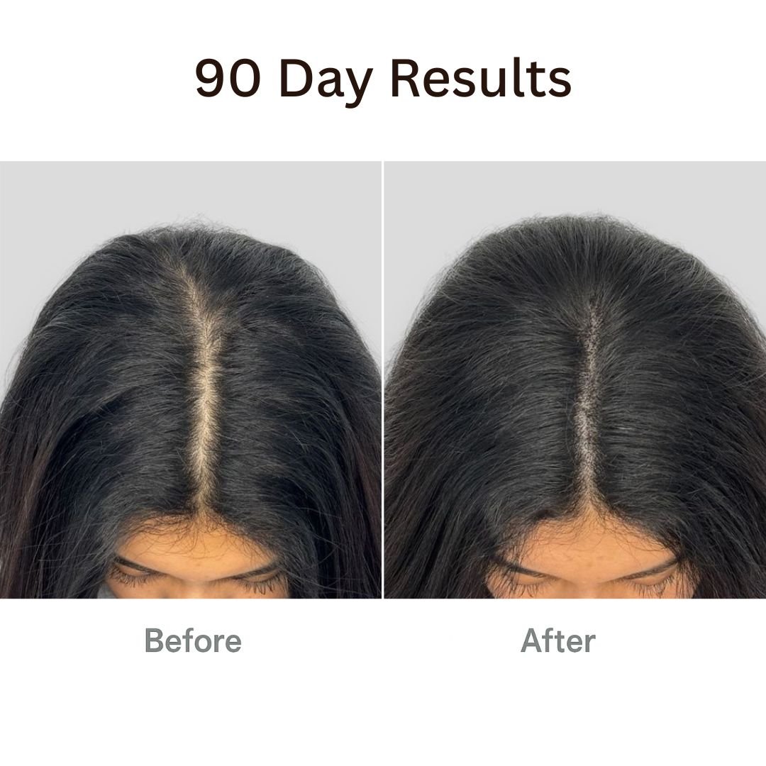 RootRevive™ Korean Scalp Renewal Serum