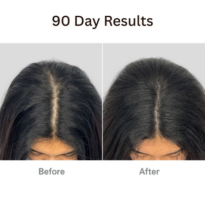 RootRevive™ Korean Scalp Renewal Serum